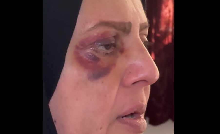 شرطة الرصافة تنفي تعرض امرأة للتعذيب: "ضربت نفسها"